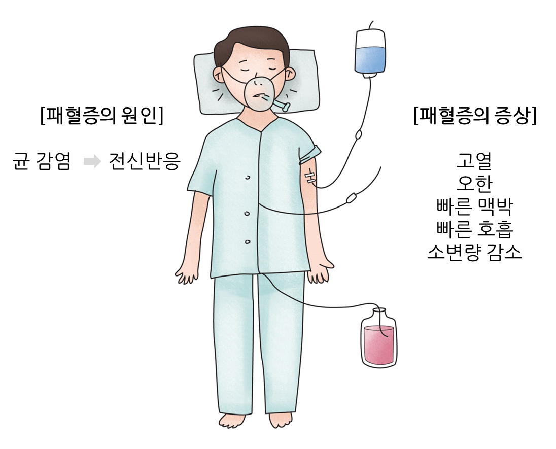 패혈증 | 메디컬칼럼 | 건강이야기 | 건강정보 | 서울아산병원